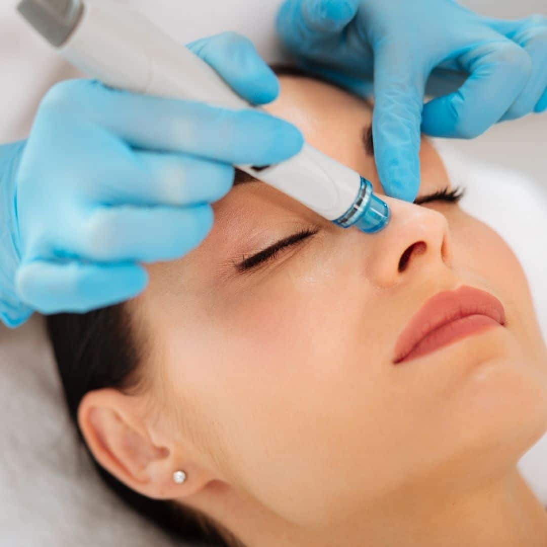 A HydraFacial treatment in progress under bright treatment-room light